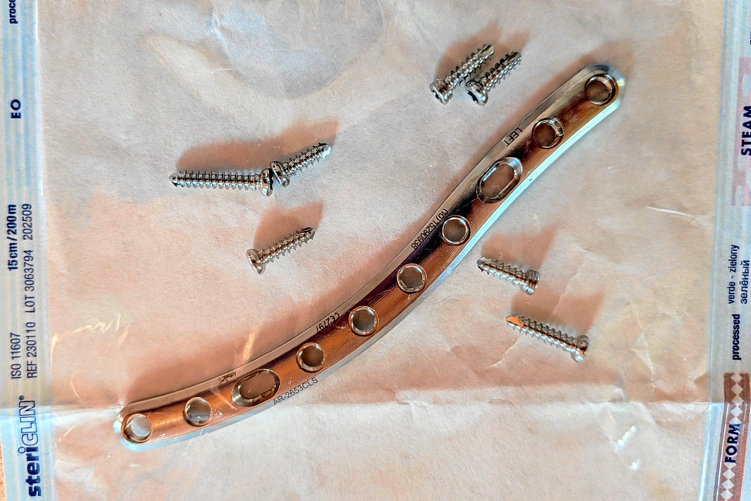 OP-BERICHT: METALLENTFERNUNG BEI UNSEREM SOHN TOMTE